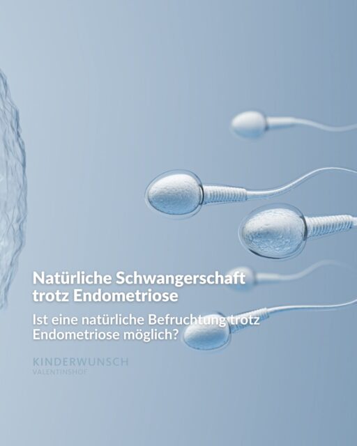 Endometriose kann die Chancen auf eine natürliche Empfängnis beeinflussen. Bis zu 50 % der Frauen mit Endometriose werden jedoch ohne medizinische Intervention schwanger. Besonders in den Monaten nach dem Absetzen der Pille oder einer operativen Entfernung von Endometriose-Herden sind die Erfolgsaussichten erhöht.

Sollte nach 6 bis 9 Monaten keine Schwangerschaft eintreten, ist es ratsam, frühzeitig eine Beratung durch Spezialisten für Reproduktionsmedizin in Anspruch zu nehmen. Mit zunehmendem Alter, insbesondere ab 35 Jahren, sinkt die Fruchtbarkeit, weshalb eine rechtzeitige Beratung wertvolle Orientierung bieten kann.

Jeder Fall ist individuell – Wir arbeiten eng mit dem Endometriosezentrum Albertinenkrankenhaus zusammen und entwickeln gemeinsam den besten Ansatz für Sie.

#EndoMarch #KinderwunschHamburg #Endometriose #EndoCommunity #EndometrioseBewusstsein