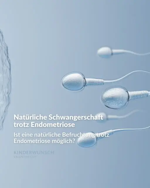 Endometriose kann die Chancen auf eine natürliche Empfängnis beeinflussen. Bis zu 50 % der Frauen mit Endometriose werden jedoch ohne medizinische Intervention schwanger. Besonders in den Monaten nach dem Absetzen der Pille oder einer operativen Entfernung von Endometriose-Herden sind die Erfolgsaussichten erhöht.

Sollte nach 6 bis 9 Monaten keine Schwangerschaft eintreten, ist es ratsam, frühzeitig eine Beratung durch Spezialisten für Reproduktionsmedizin in Anspruch zu nehmen. Mit zunehmendem Alter, insbesondere ab 35 Jahren, sinkt die Fruchtbarkeit, weshalb eine rechtzeitige Beratung wertvolle Orientierung bieten kann.

Jeder Fall ist individuell – Wir arbeiten eng mit dem Endometriosezentrum Albertinenkrankenhaus zusammen und entwickeln gemeinsam den besten Ansatz für Sie.

#EndoMarch #KinderwunschHamburg #Endometriose #EndoCommunity #EndometrioseBewusstsein